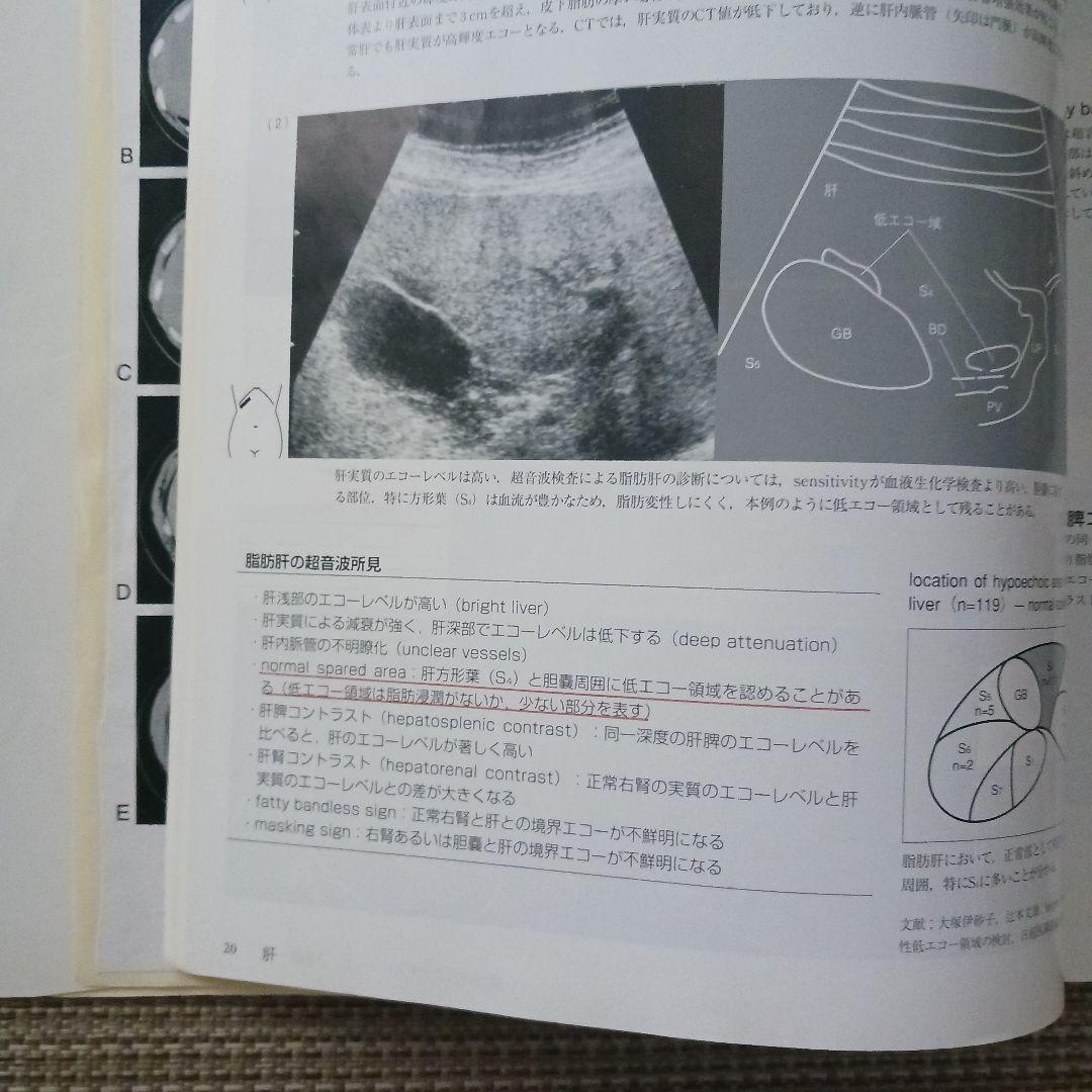 腹部超音波テキスト : 上・下腹部　腹部エコー　参考書　ベクトル・コア