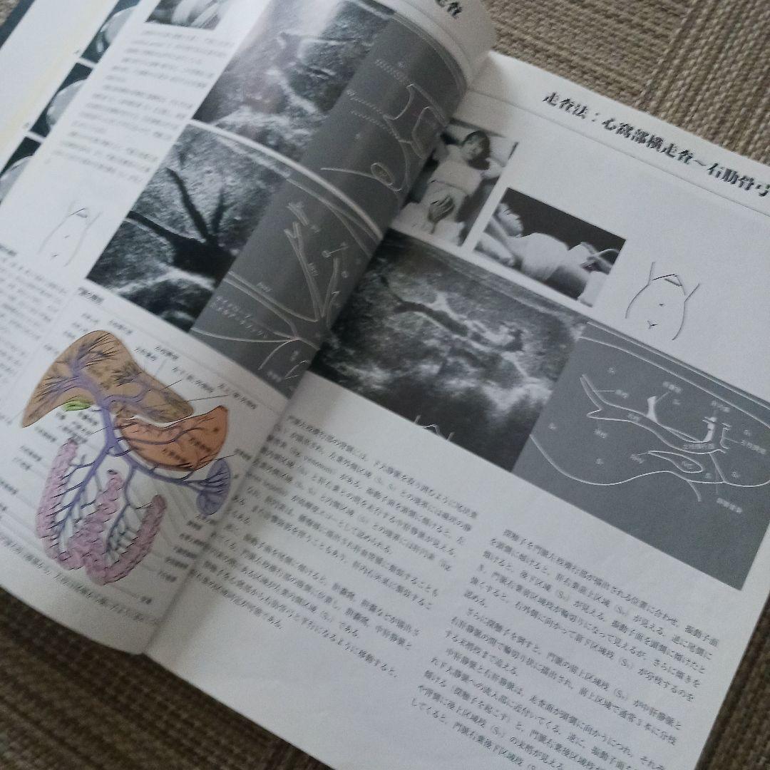 腹部超音波テキスト : 上・下腹部　腹部エコー　参考書　ベクトル・コア
