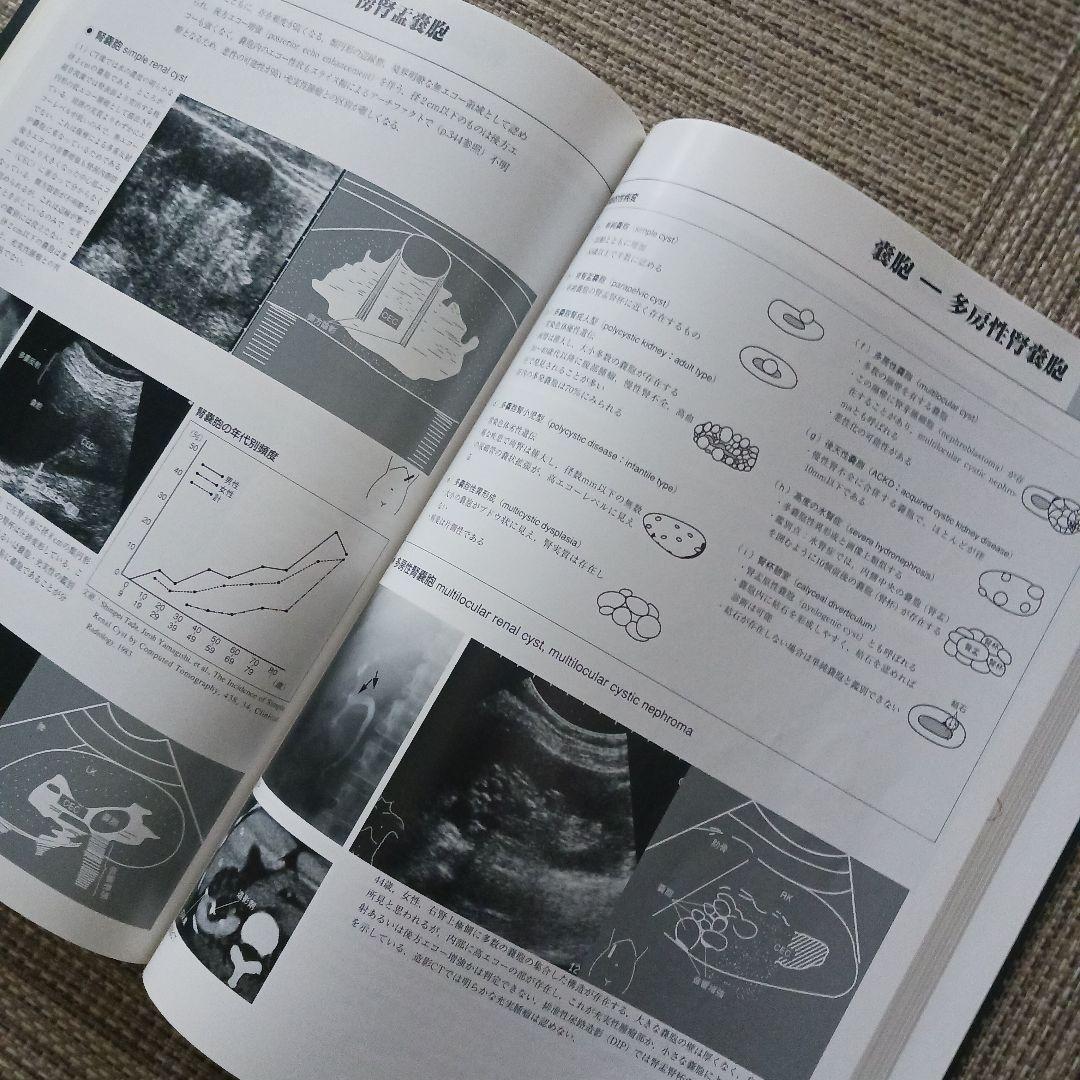 腹部超音波テキスト : 上・下腹部　腹部エコー　参考書　ベクトル・コア