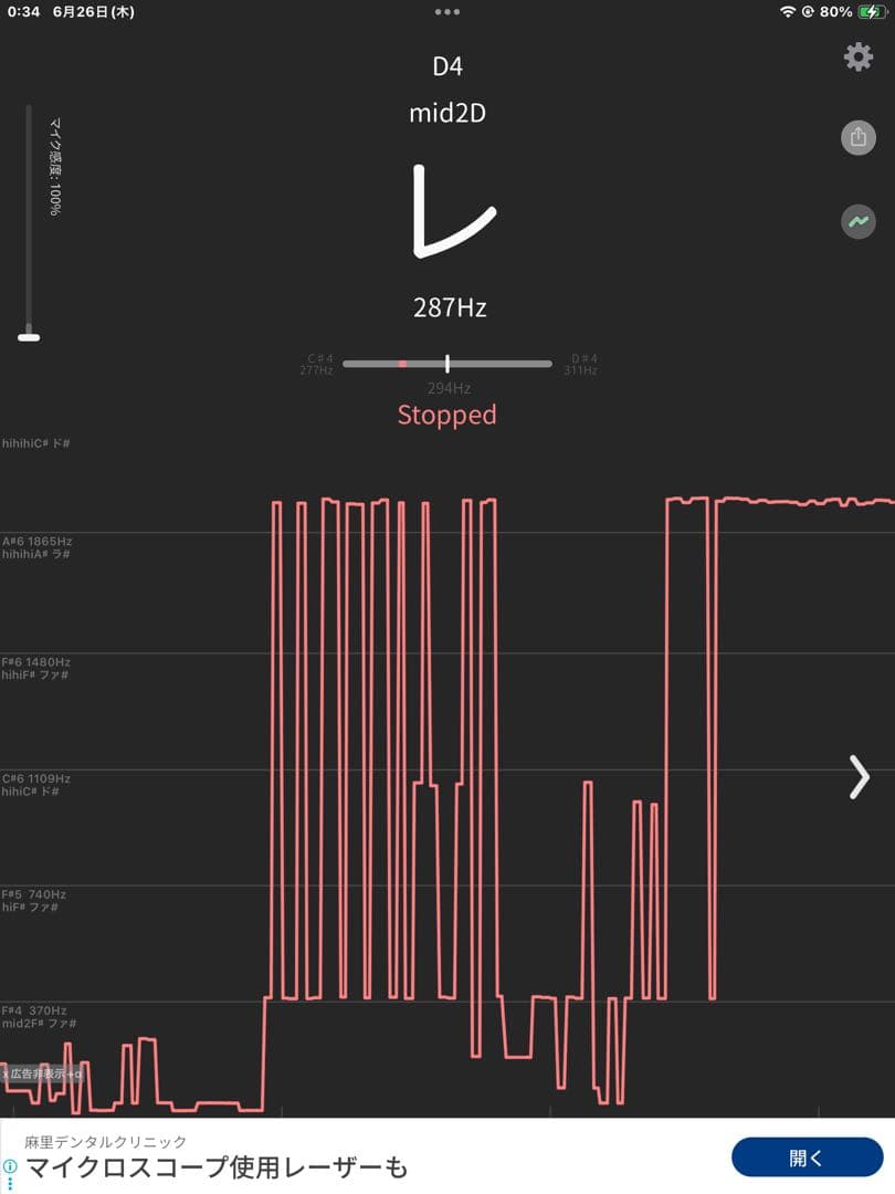 No52 チベット産 シンギングボウル 新品 チベタンボウル 16cm 仏陀顔