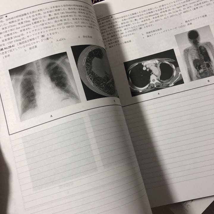 医師国家試験対策