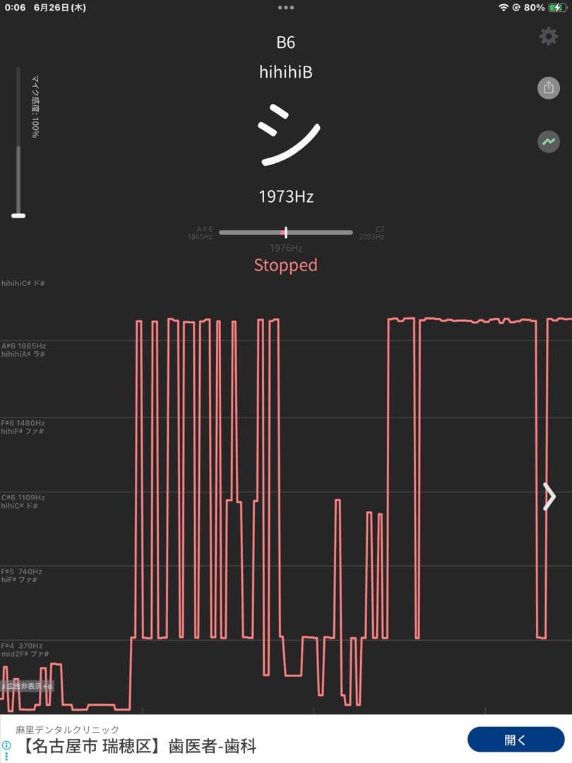 no50チベット産 シンギングボウル 新品 チベタンボウル 15cm AUM