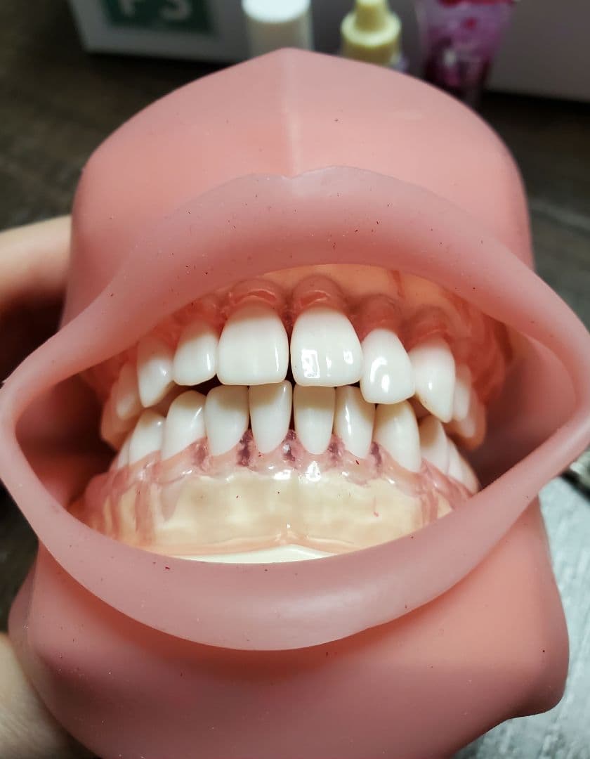 【ニッシン】 歯科模型 頬粘膜 歯科衛生士 NISSIN デンタルモデル