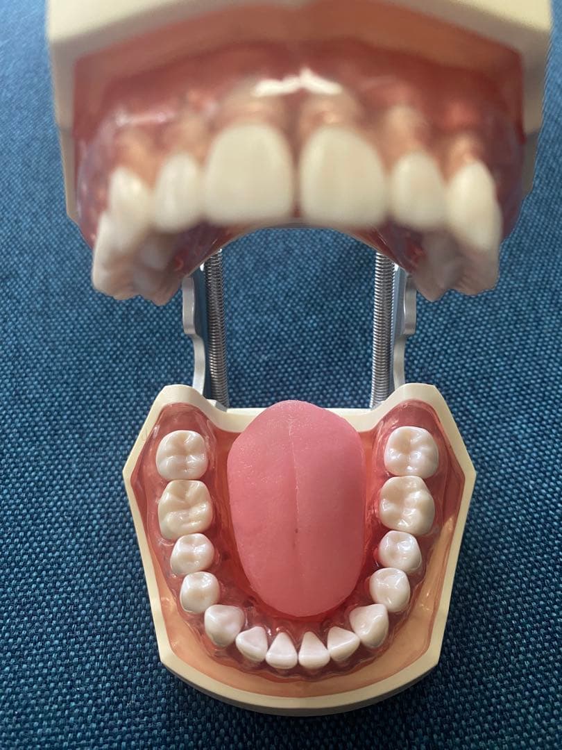 顎模型　人工歯石　セット売り　歯科